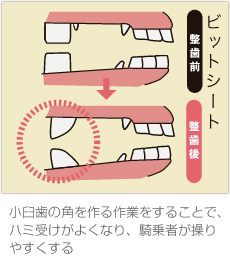 ビットシート